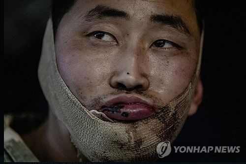 우크라이나군에 생포된 북한군.<연합뉴스>